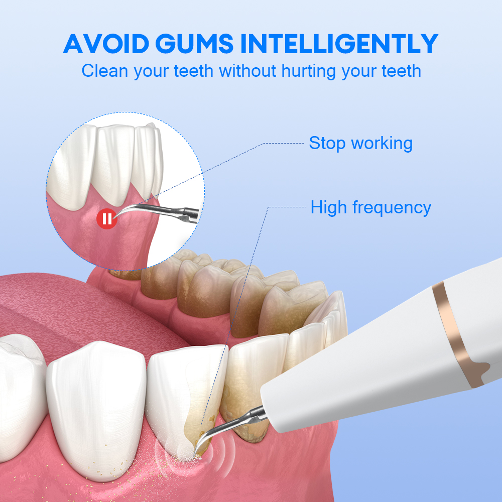 Ultrasonic Teeth Tartar Cleane - Teeth Whitening Mouthwash 评论和价格